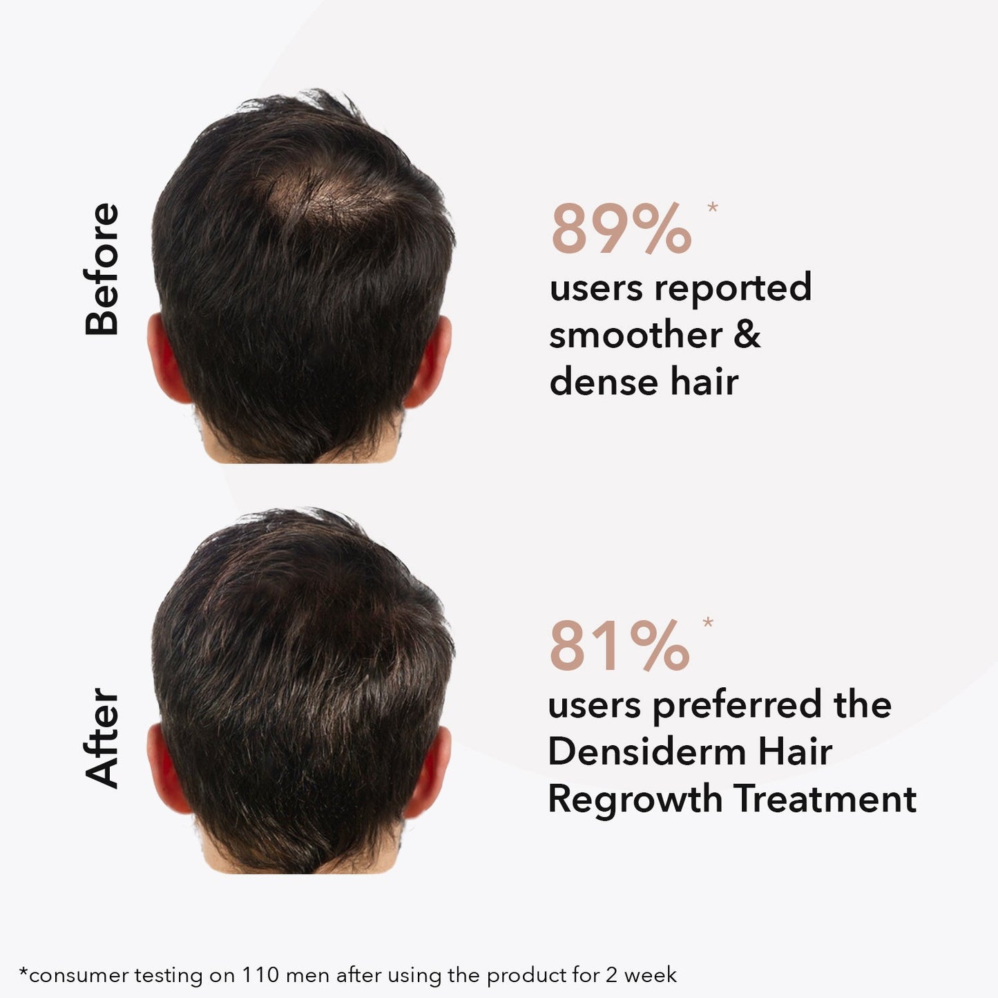 O3+ Densiderm Scalp Spray for Men | 50 ml | iBellaa