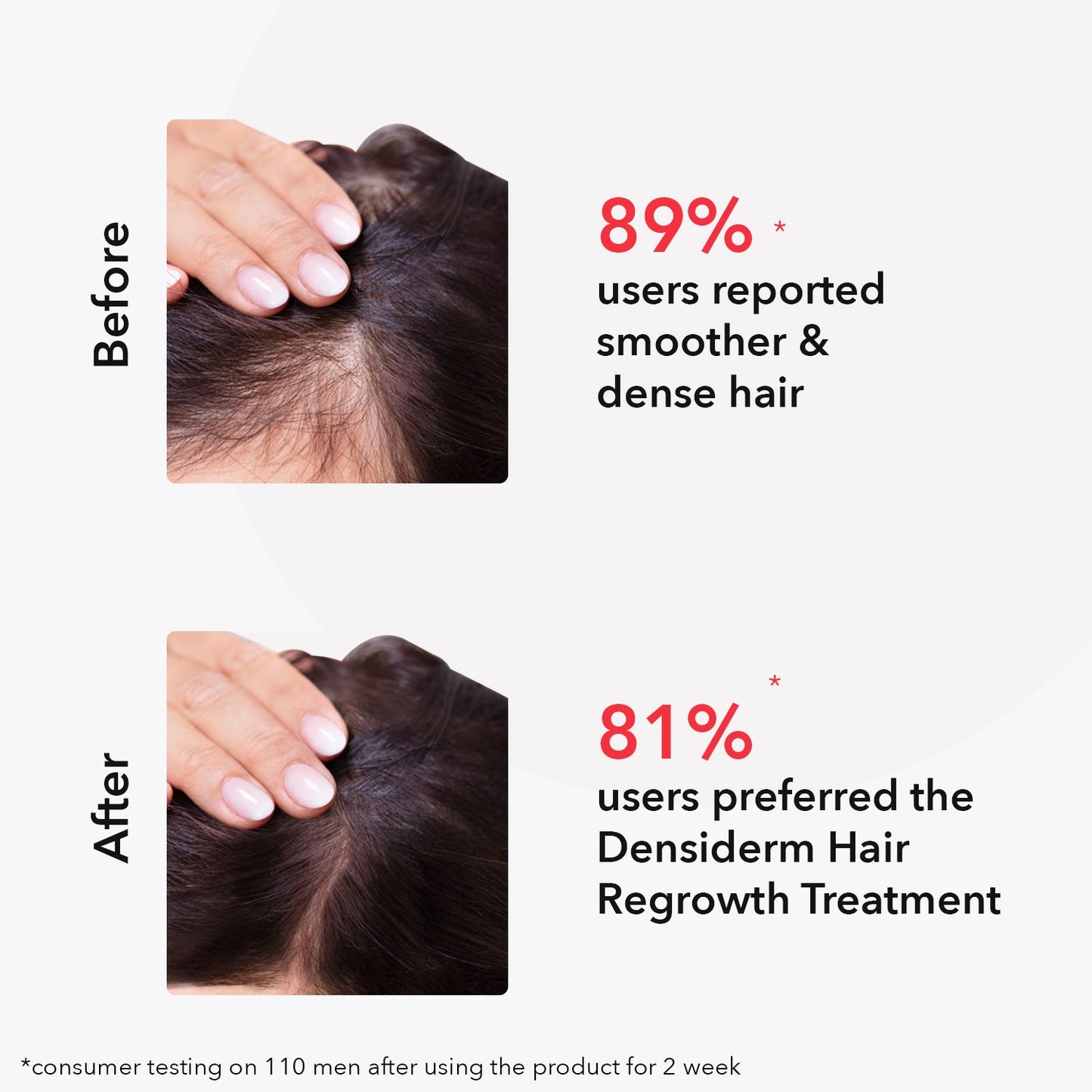 O3+ Densiderm Scalp Spray for Women | 50 ml | iBellaa