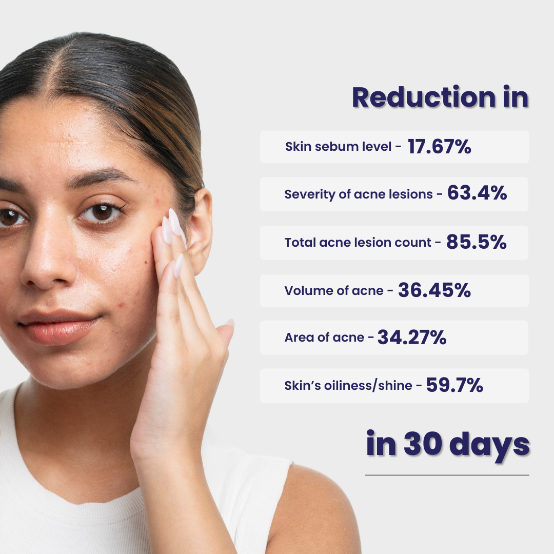Re'equil Oil Control Face Wash | 200 ml | iBellaa