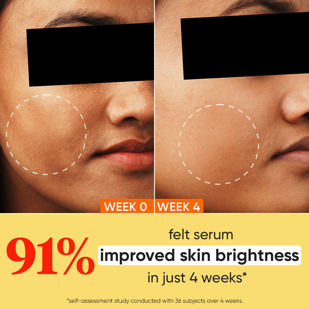DOT & KEY 10% Vitamin C + E Face Serum with 5% Niacinamide | iBellaa