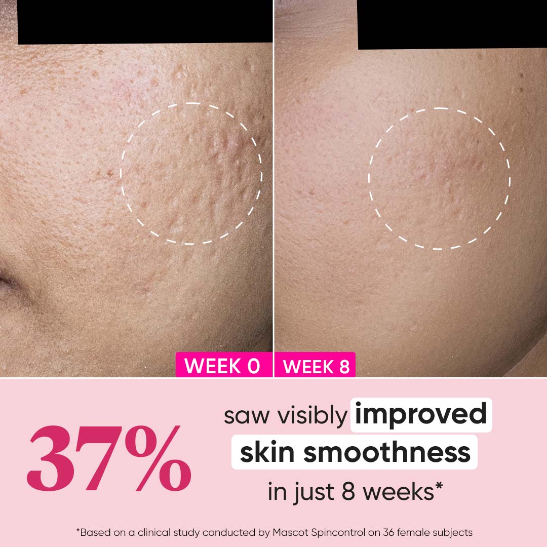DOT & KEY Retinol + Ceramide Night Cream for Fine Lines & Wrinkles | 60 ml | iBellaa