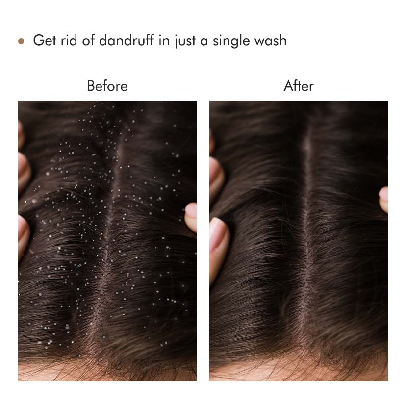 mCaffeine Coffee Scalp Scrub - 250g | iBellaa
