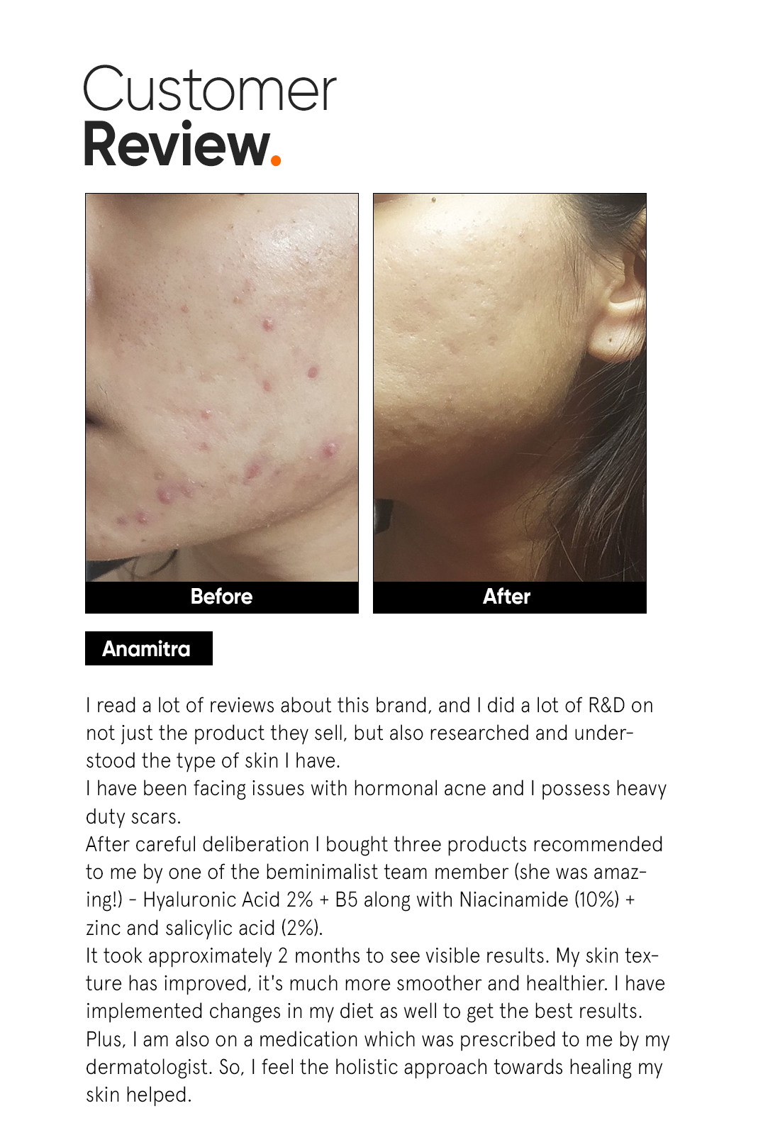 Minimalist Hyaluronic + PGA 2% Face Serum | 30 ml | iBellaa