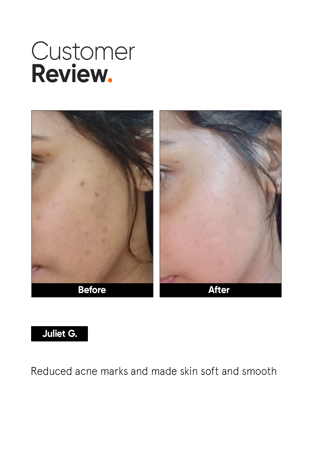Minimalist Niacinamide 5% Face Serum | 30 ml | iBellaa