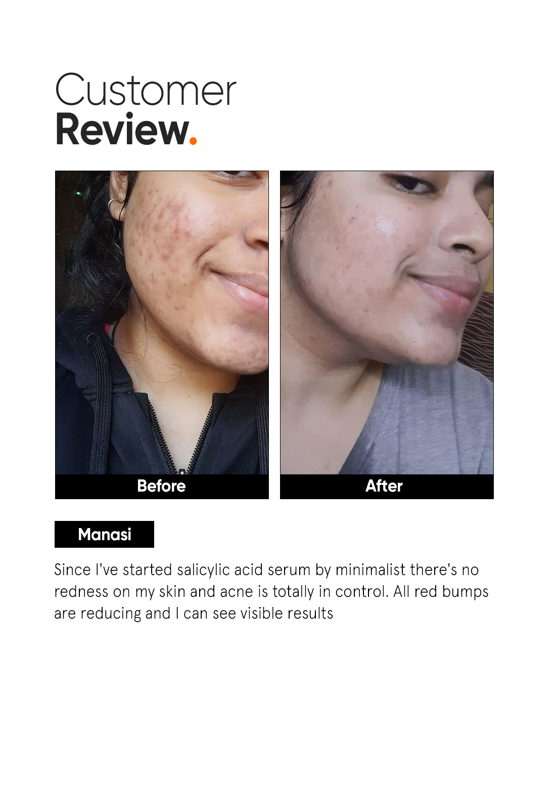 Minimalist Salicylic Acid 2% Face Serum | iBellaa