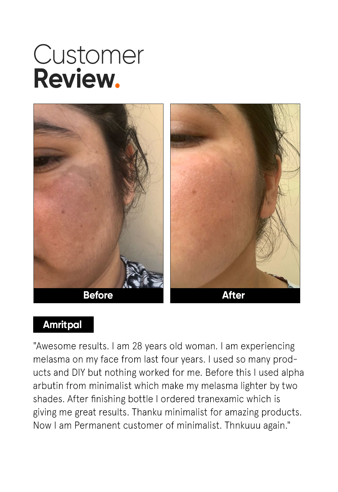 Minimalist Tranexamic 3% Face Serum | 30 ml | iBellaa