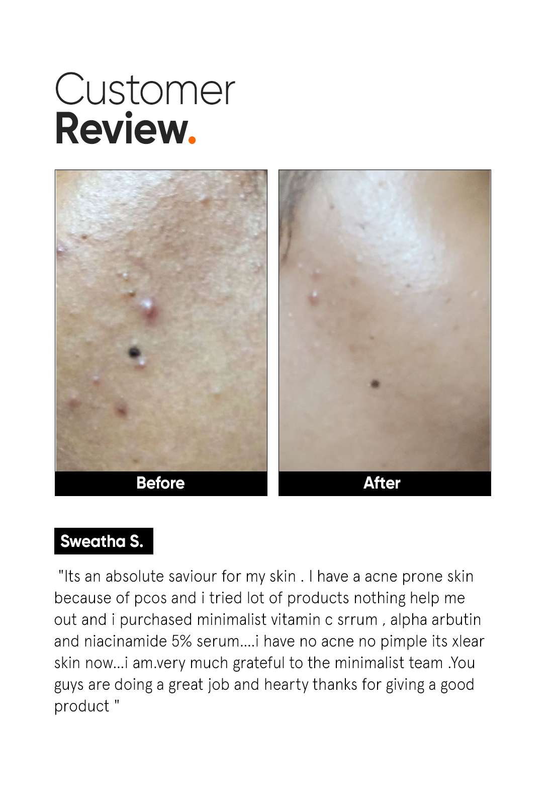 Minimalist Vitamin C 10% Face Serum | 30 ml | iBellaa